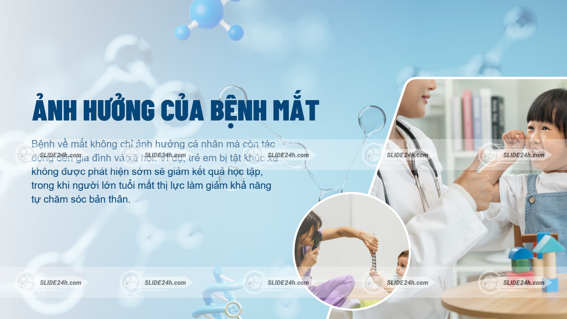 Ảnh hưởng của bệnh về mắt