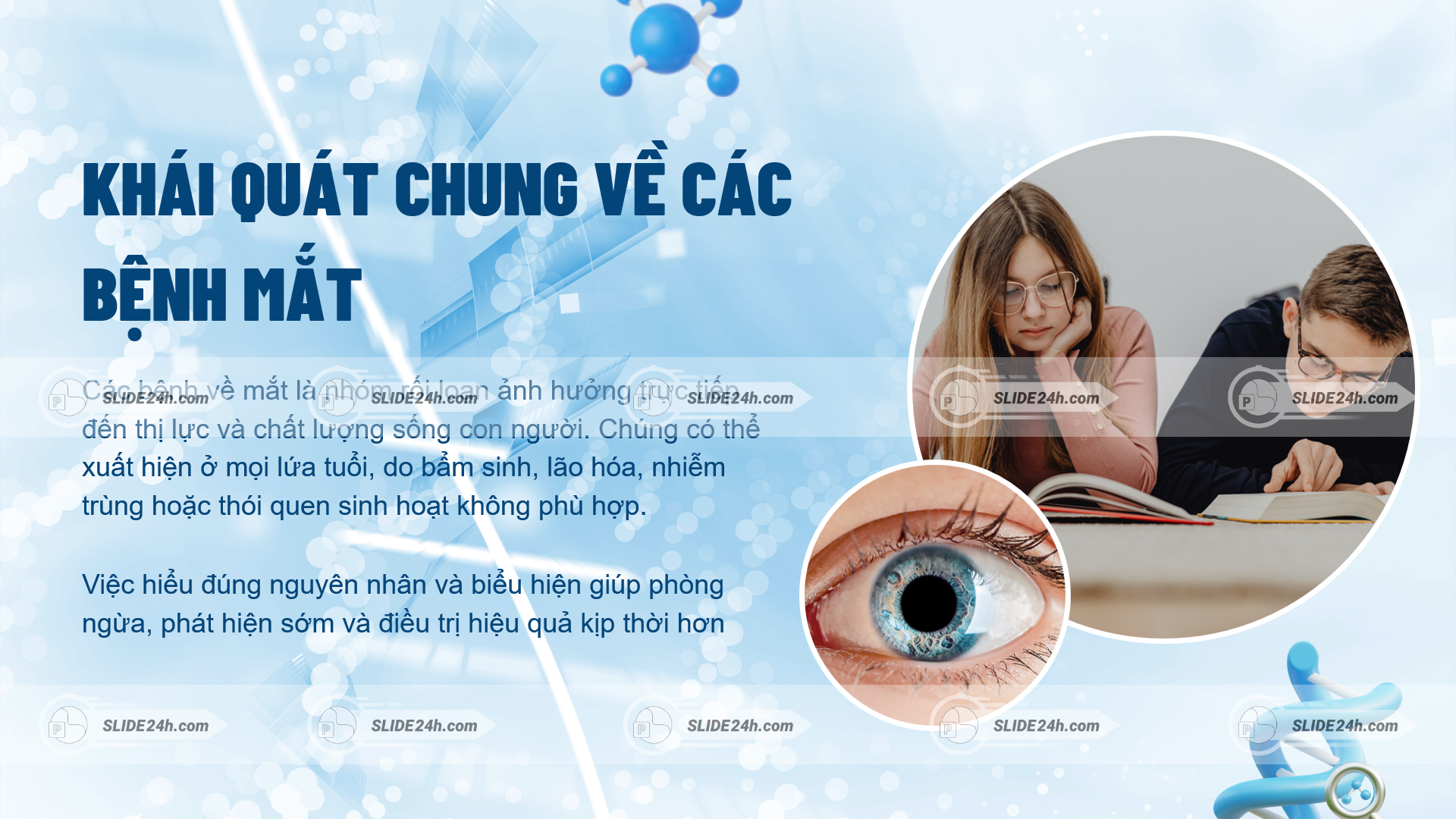 Khái quát chung bệnh về mắt