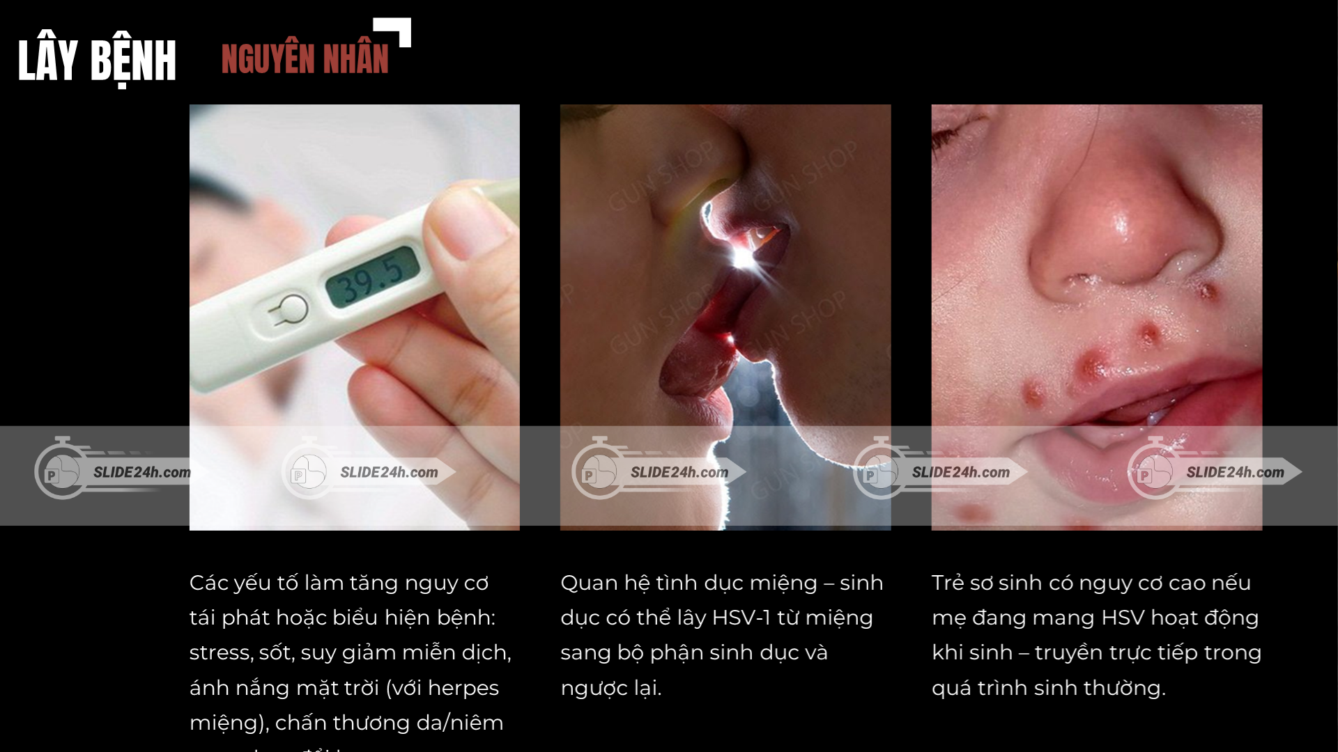 nguyên nhân lây bệnh HSV