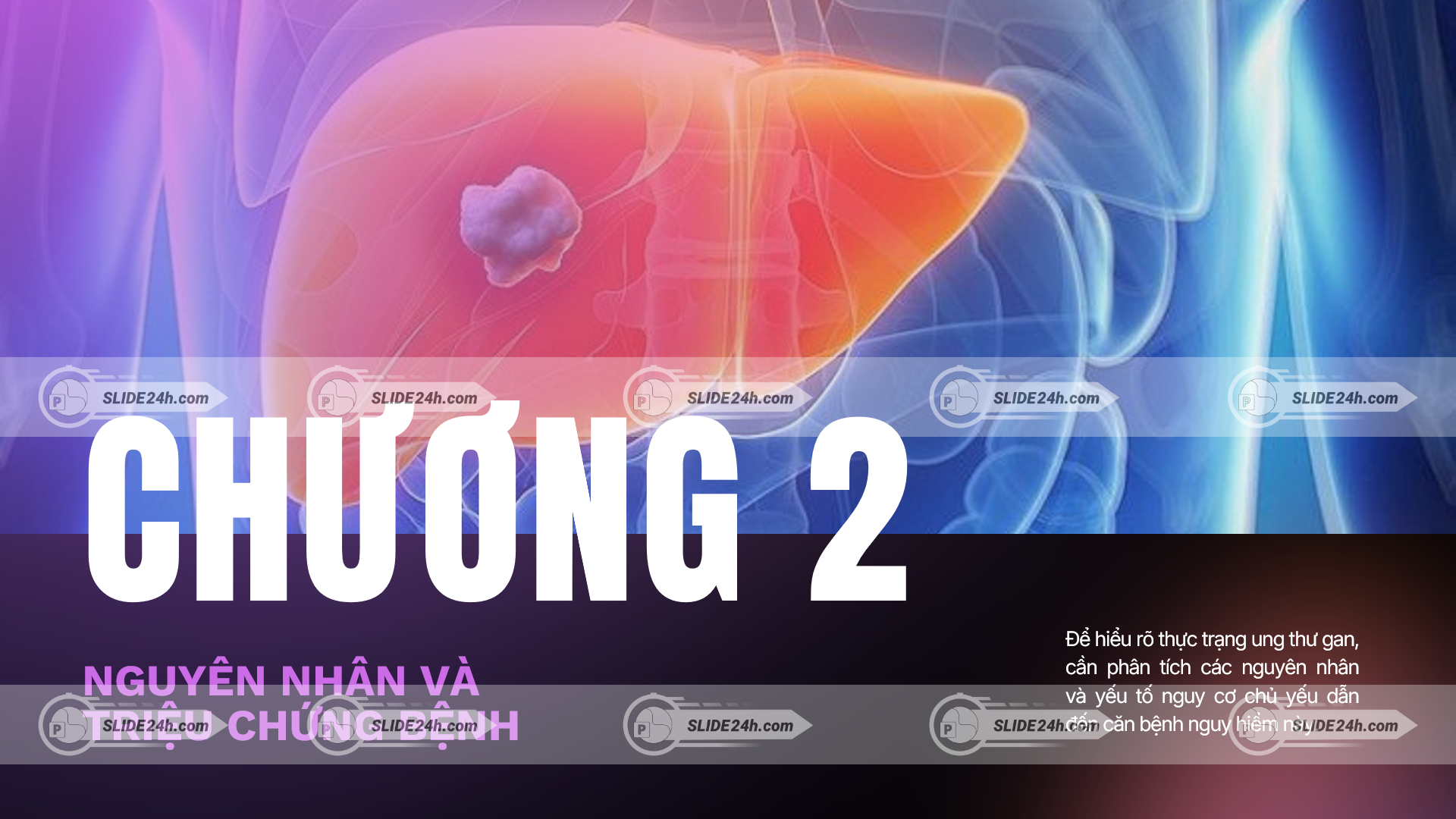 nguyên nhân và triệu chứng ung thư gan qua hình ảnh minh họa giúp nhận biết dấu hiệu bệnh