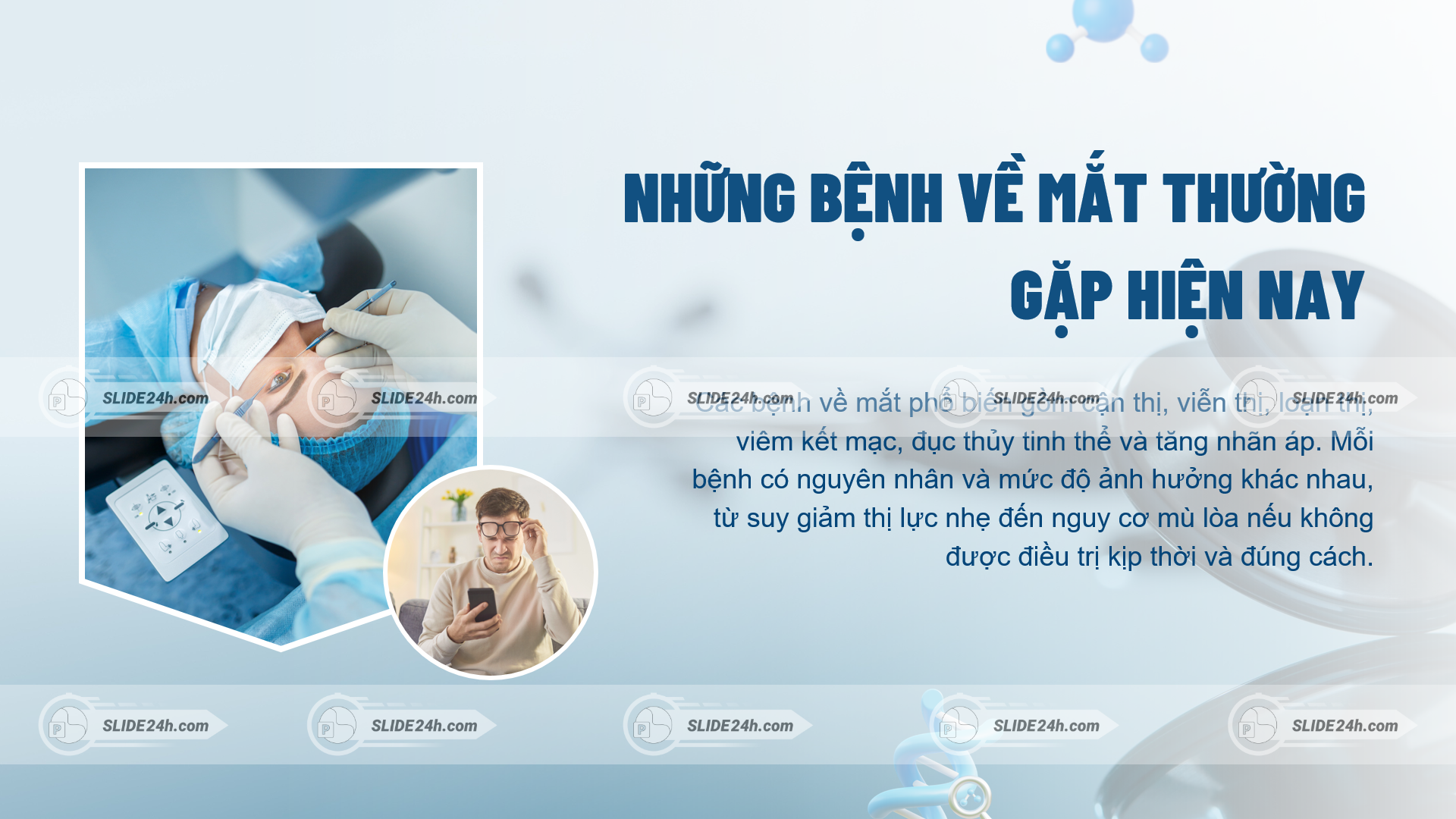 Nhóm bệnh về mắt phổ biến hiện nay