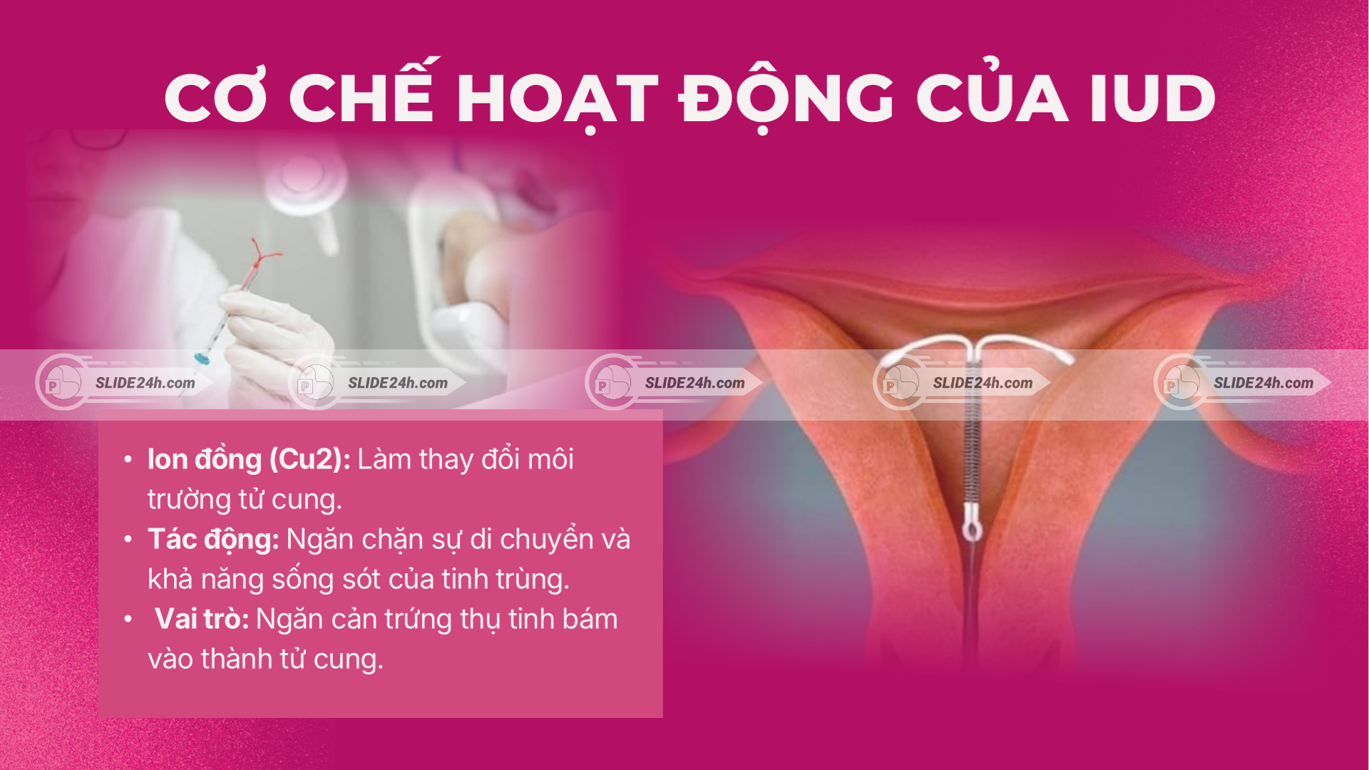 Slide cơ chế tác động của thuốc tránh thai khẩn cấp