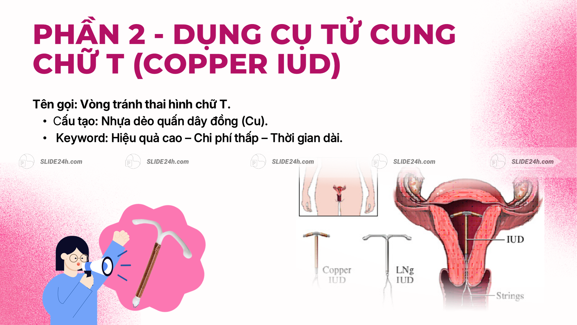 Slide giới thiệu dụng cụ tử cung chữ T Copper IUD