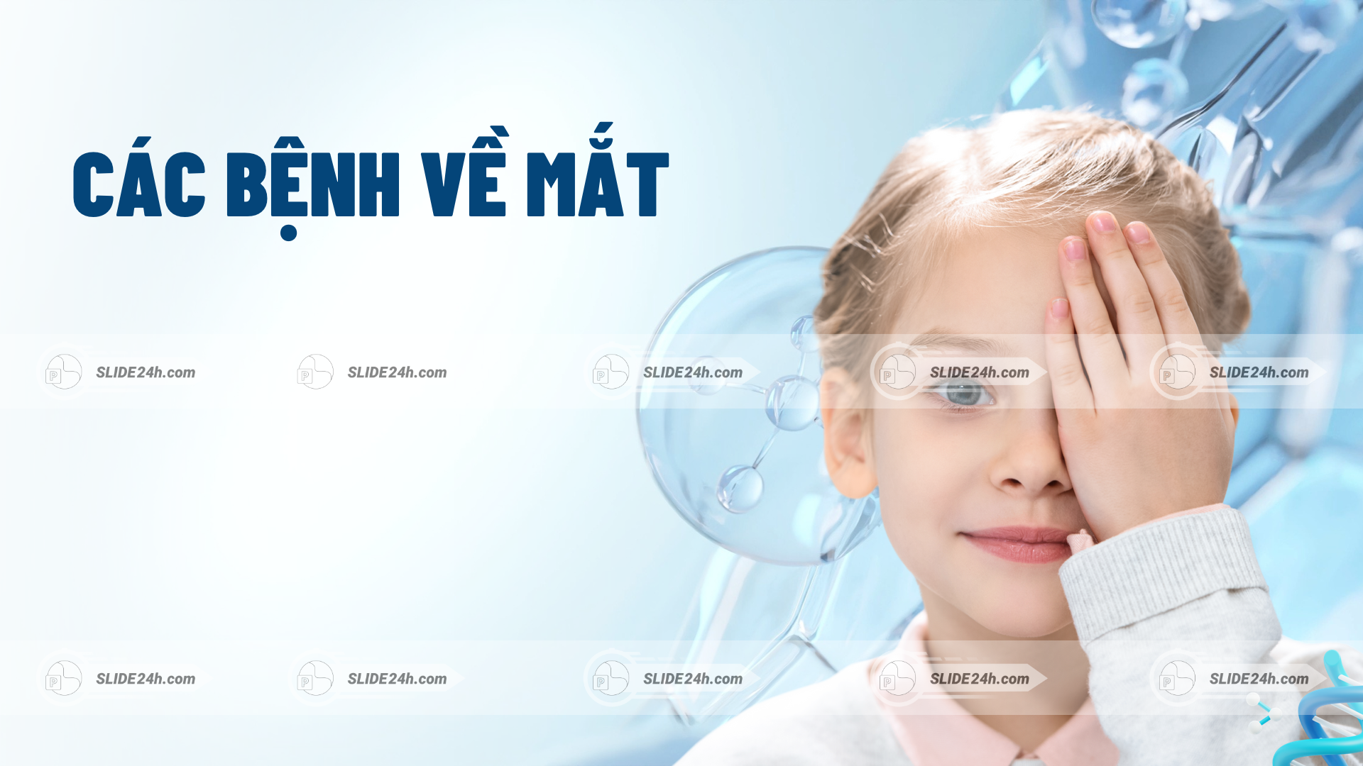 Slide thuyết trình Các bệnh về mắt