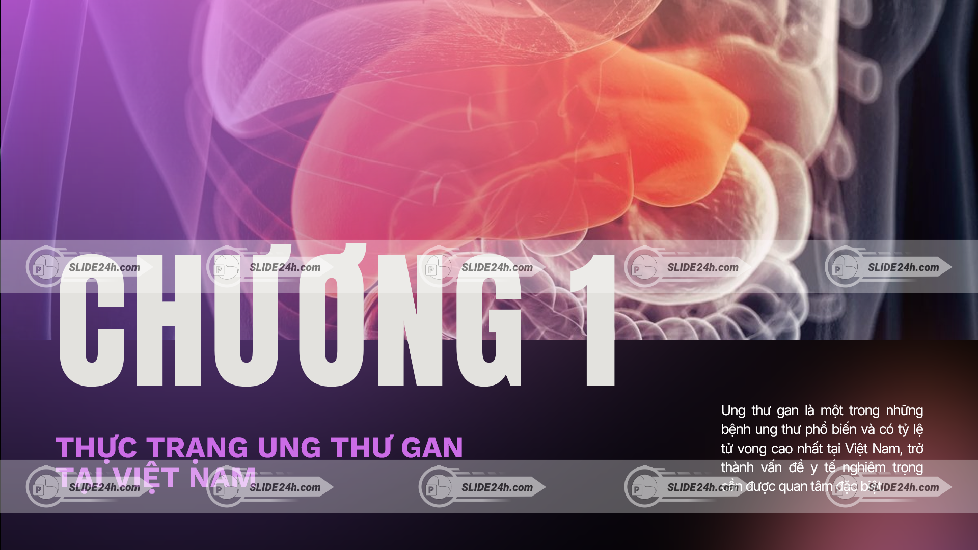 thực trạng ung thư gan tại việt nam với hình ảnh minh họa cơ quan gan và thông tin cảnh báo
