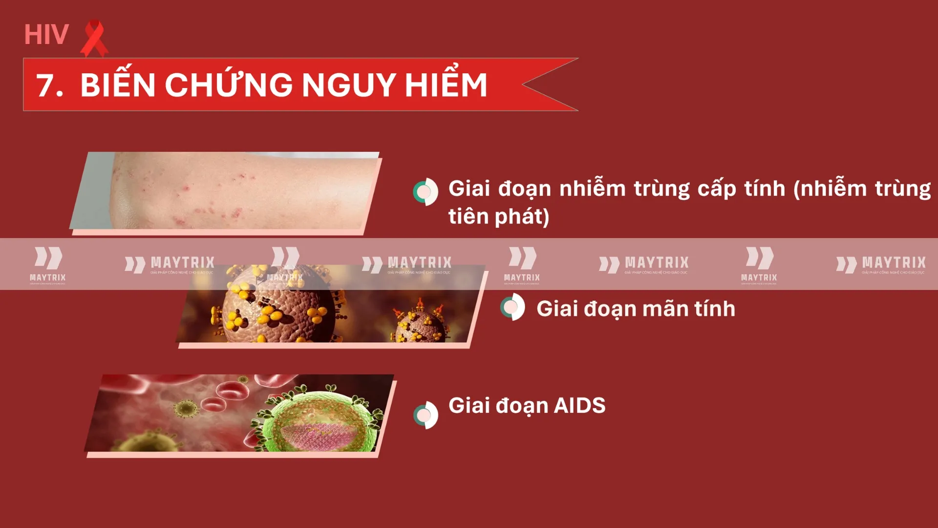 slide-virus-hiv (8)